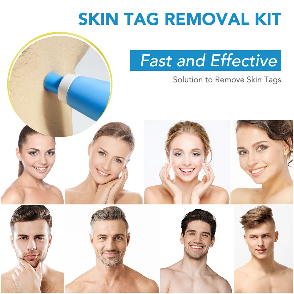 Rubber Rings Face Mole Removal Tool Kits Safety Painless Remove Skin Wart Kits Face Beauty Accessories for Neck Chin Back