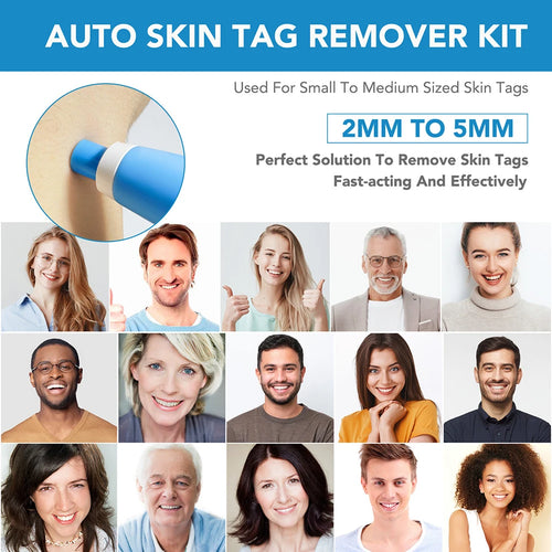Load image into Gallery viewer, Rubber Rings Face Mole Removal Tool Kits Safety Painless Remove Skin Wart Kits Face Beauty Accessories for Neck Chin Back
