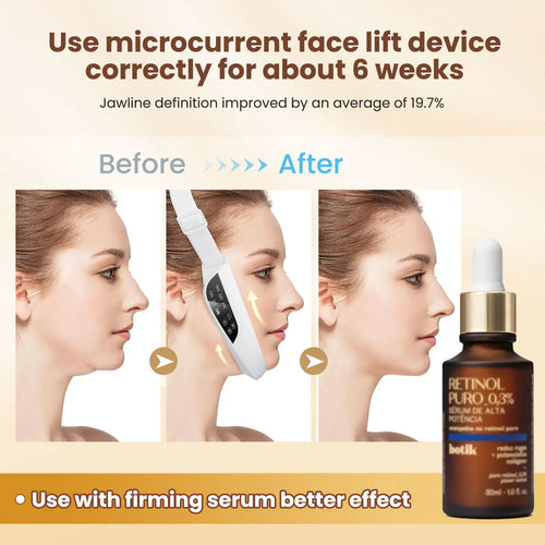 Load image into Gallery viewer, EMS Face Lifting Massager Anti Wrinkle Facial Massager V-Face Lift Device Face Slimming Remover Double Chin LED Photon Therapy
