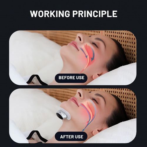 Load image into Gallery viewer, SmartSnore™ 5-Pair EMS Anti-Snoring Device – Breathe Easy, Sleep Deep
